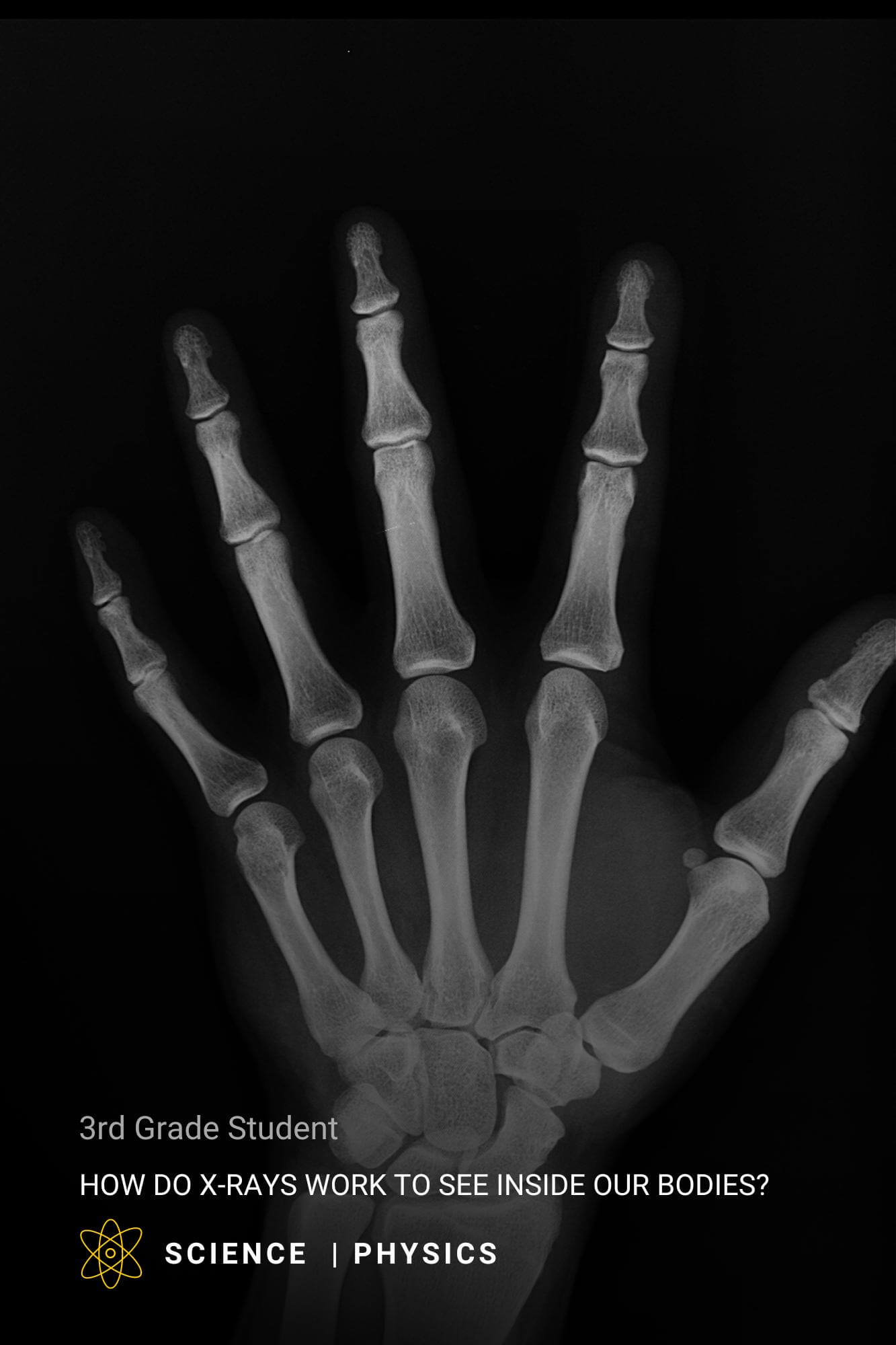 xray of a hand